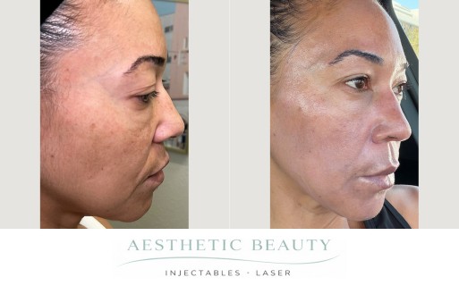 3D Miracl Before and After Image