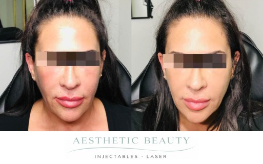 Threads Before and After Image