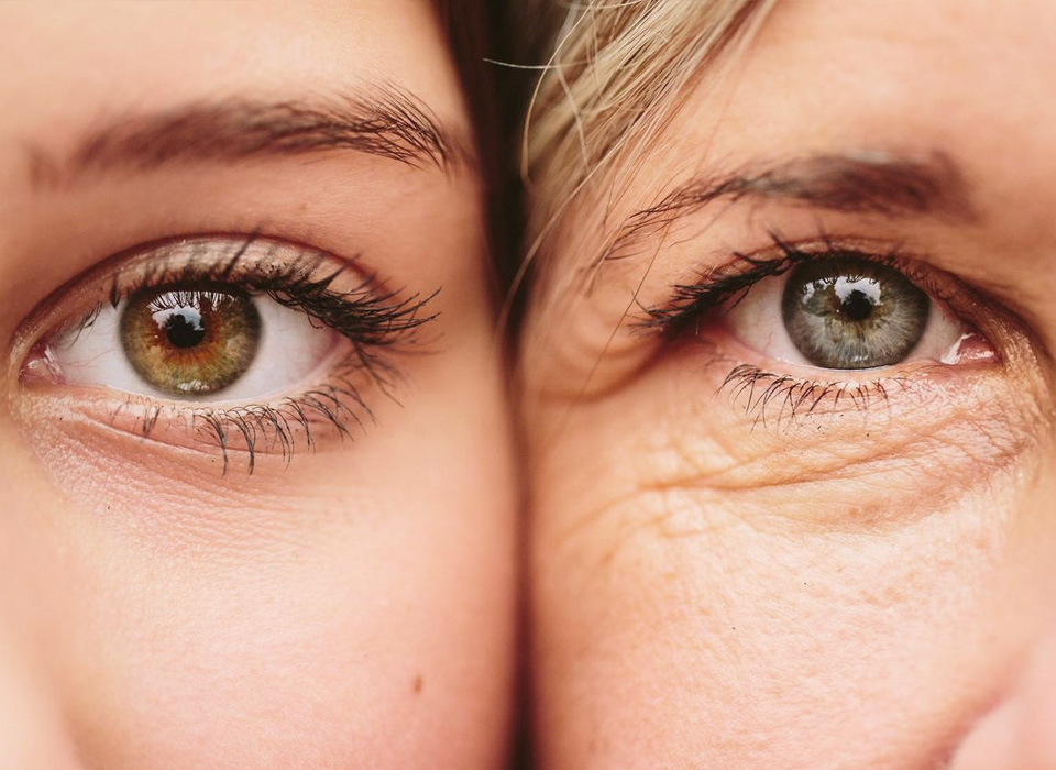 Image of Left and right eyes of a woman