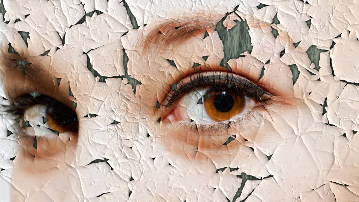 Featured image for Can Dry Skin Cause Wrinkles