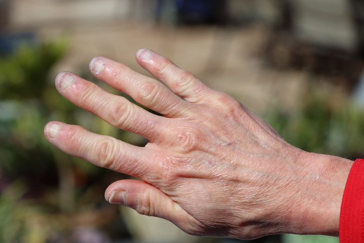 Mature hand with signs of aging.